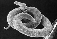 Pic of Schistosome