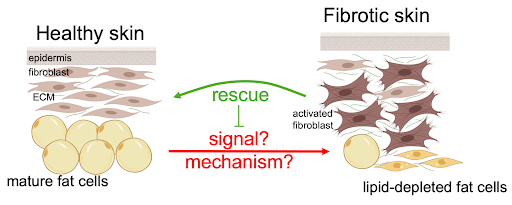 Healthy skin vs fibrotic skin