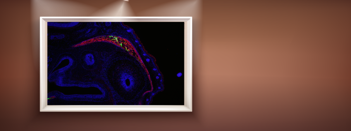Mouse embryonic frontal bone osteoblasts (red) and mineralized bone (green).