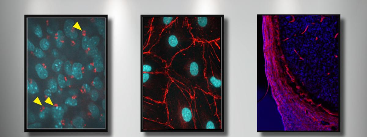 Calvarial osteoblasts in mouse