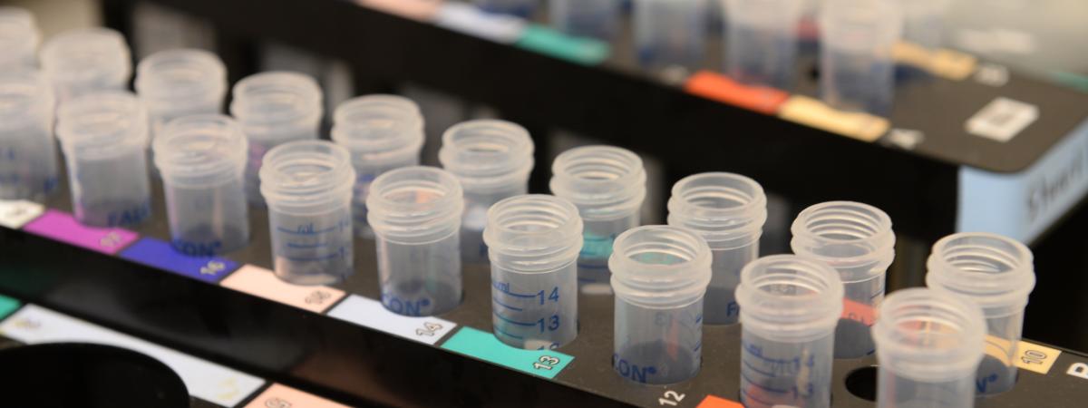 A tray of samples in plastic test tubes with colorful labels.