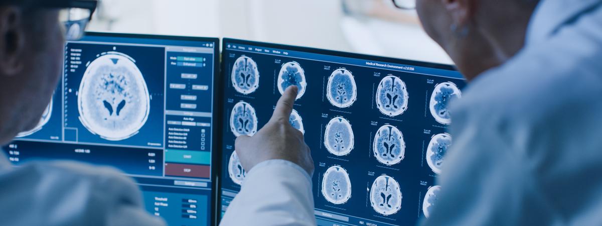 Researchers examine monitors showing brain scans results