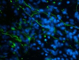 Image of NF positive fibers regenerating through SCI