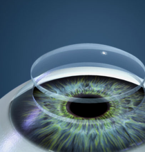 contact lens