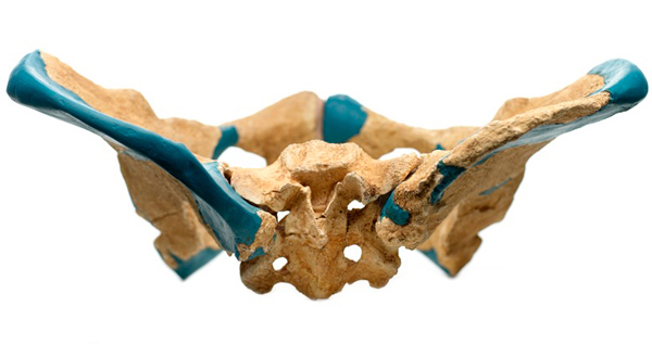 Reconstructed pelvic bone