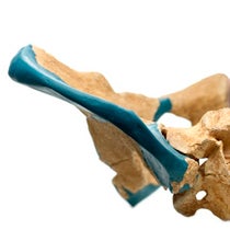 pelvic bone