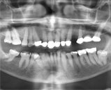 Radiograph