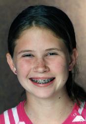 Case Western Reserve Braces Patient