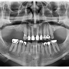 Tooth with explanation of its parts.