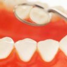 Health gums with teeth inside mouth.