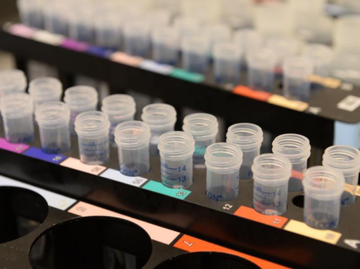 A tray of samples in plastic test tubes with colorful labels.