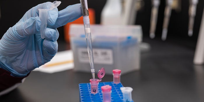 Gloved hand with a pipette